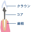 ファイバーコア