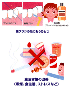 予防歯科